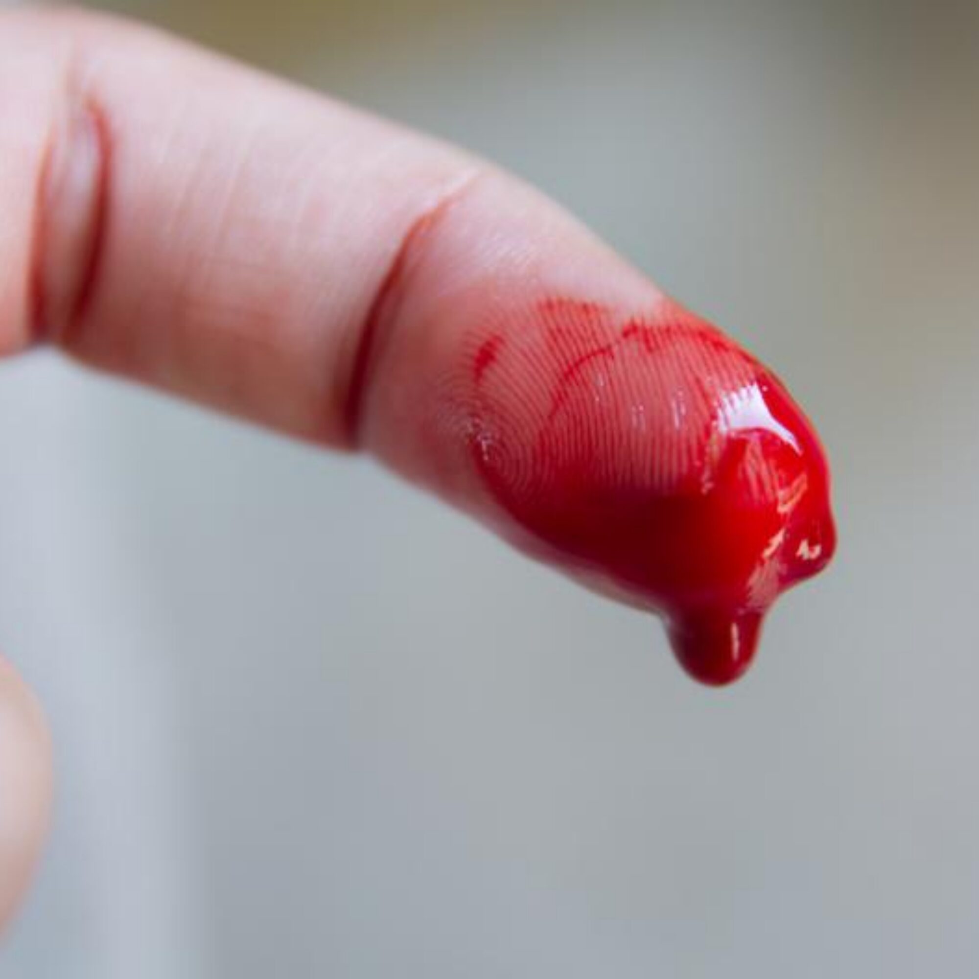 The rare taste of blood