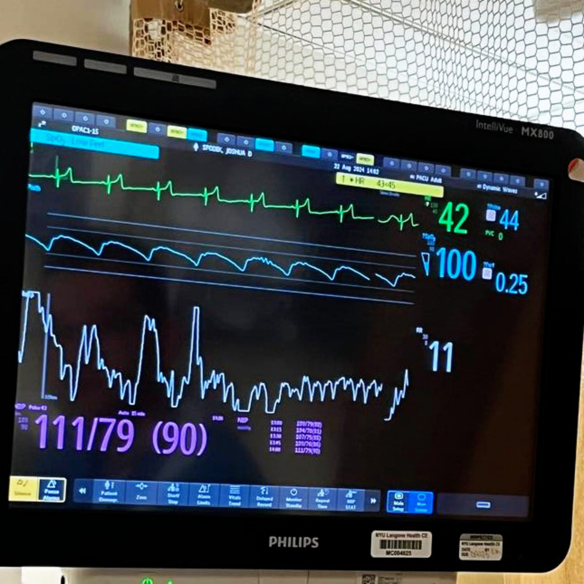 Resting heart rate: 44 beats per minute*